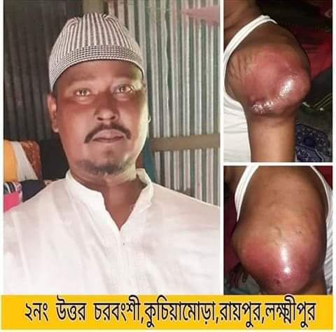 ক্যান্সারে আক্রান্ত জাকির বকসীর জন্য সাহায্যের আবেদন।
