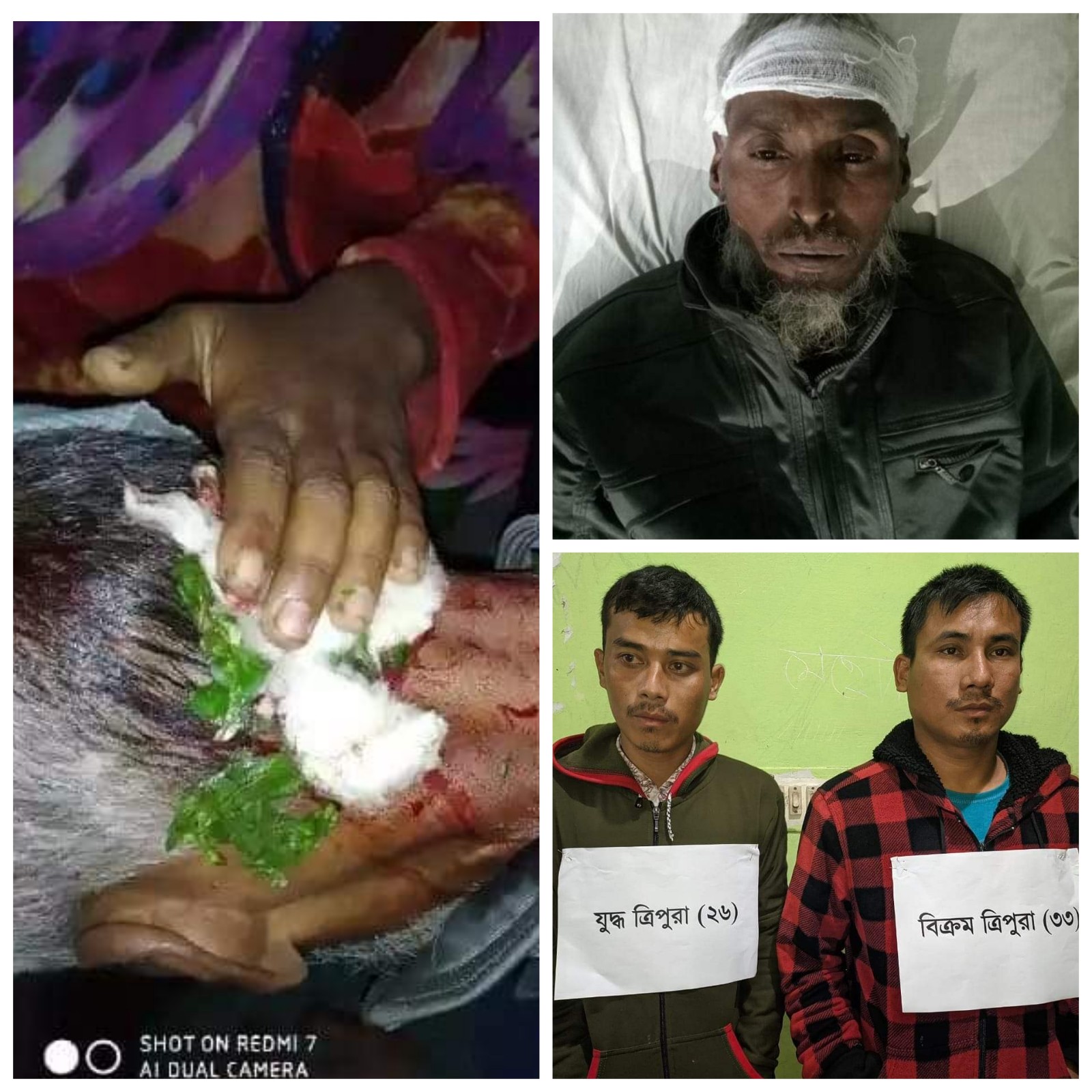 খাগড়াছড়ির মাটিরাঙ্গাতে উপজাতিয় সন্ত্রাসী হামলায় বাঙ্গালী কৃষক আহত, আটক ২।